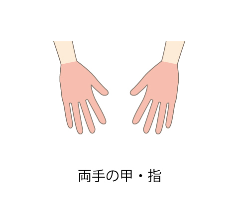 両手の甲・指